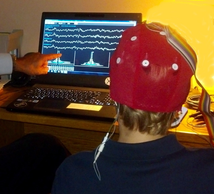 QEEG Brain Mapping