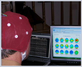 QEEG Mapping